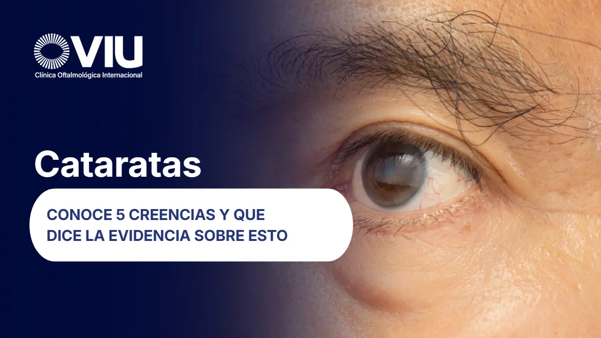 Cinco creencias sobre la catarata- VIU Clínica Oftalmológica Internacional