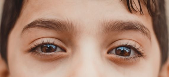 cofca blog parpados caidos