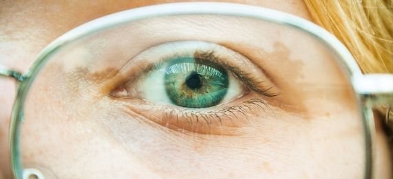 cofca cirugia facorefractiva