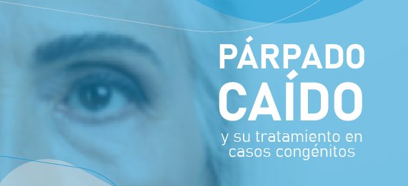 parpado caido y su tratamiento en casos congenitos