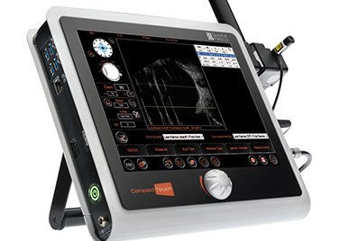 Img ecografia ocularl