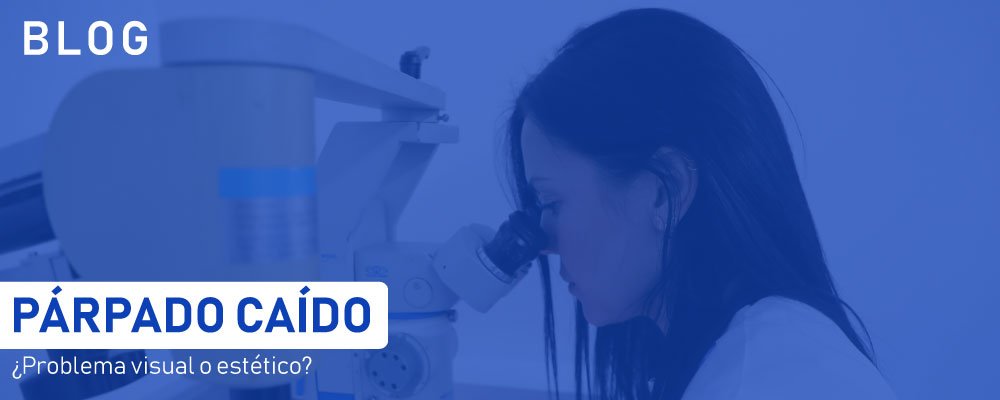 PÁRPADO CAÍDO