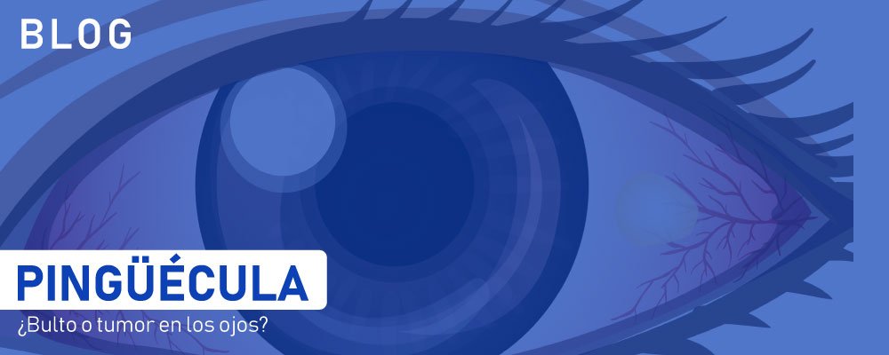 pinguécula tumor en los ojos