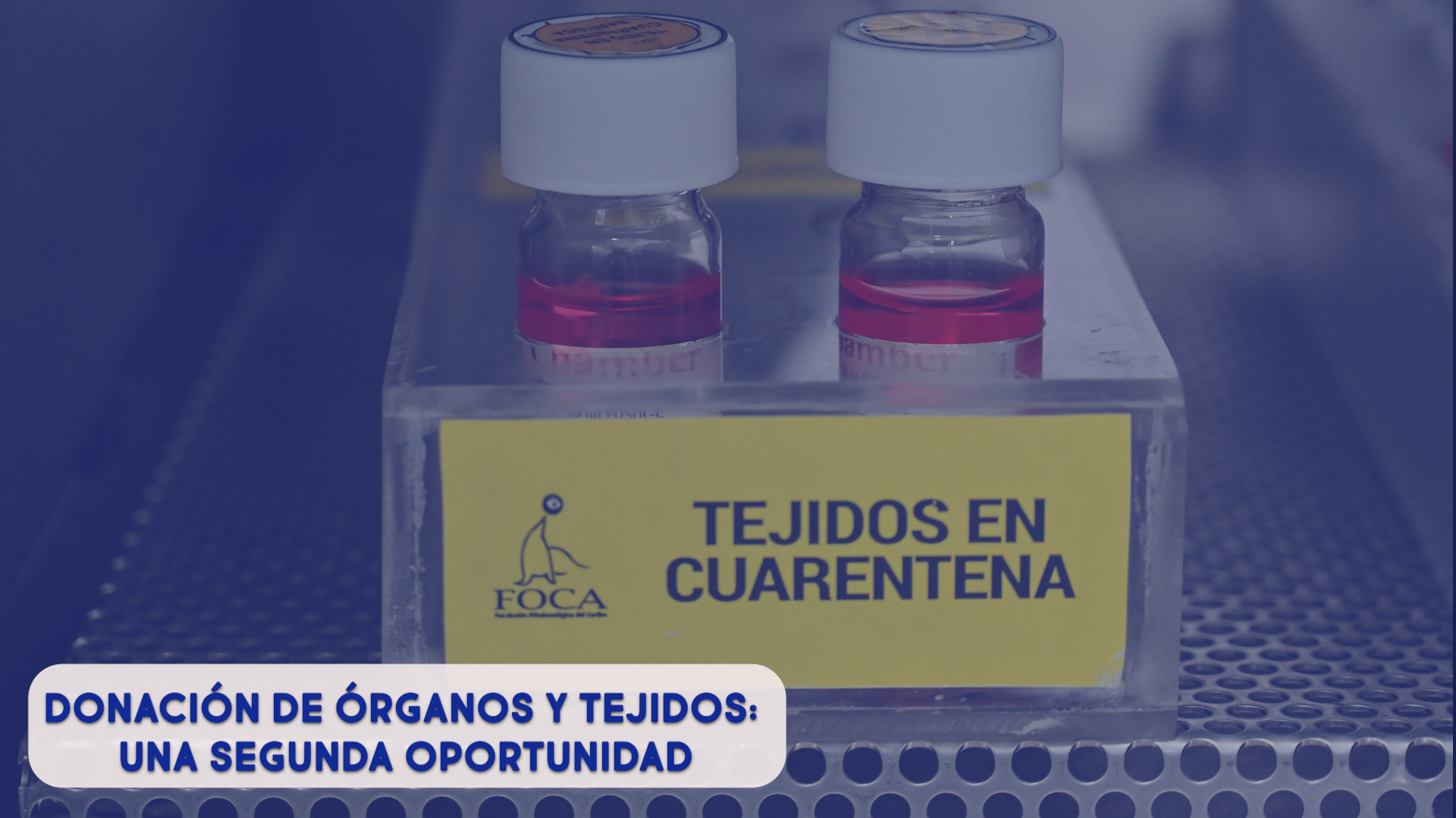 donación de órganos