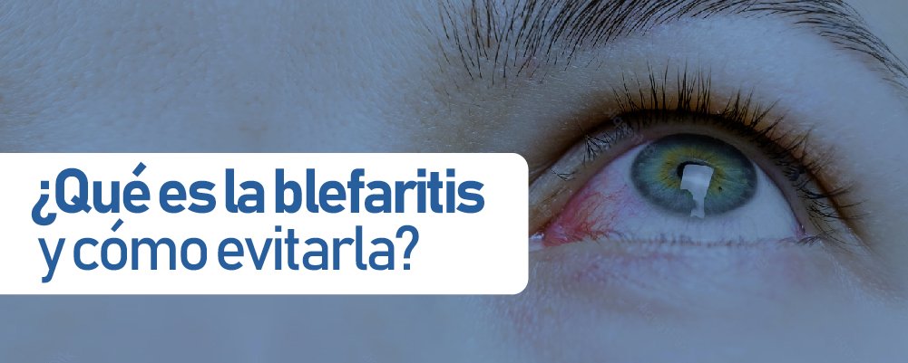 blefaritis