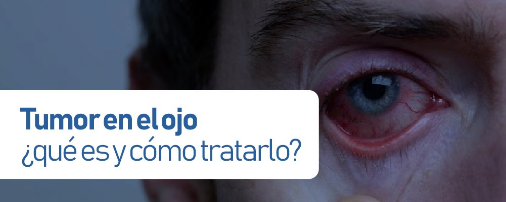 tumor en el ojo