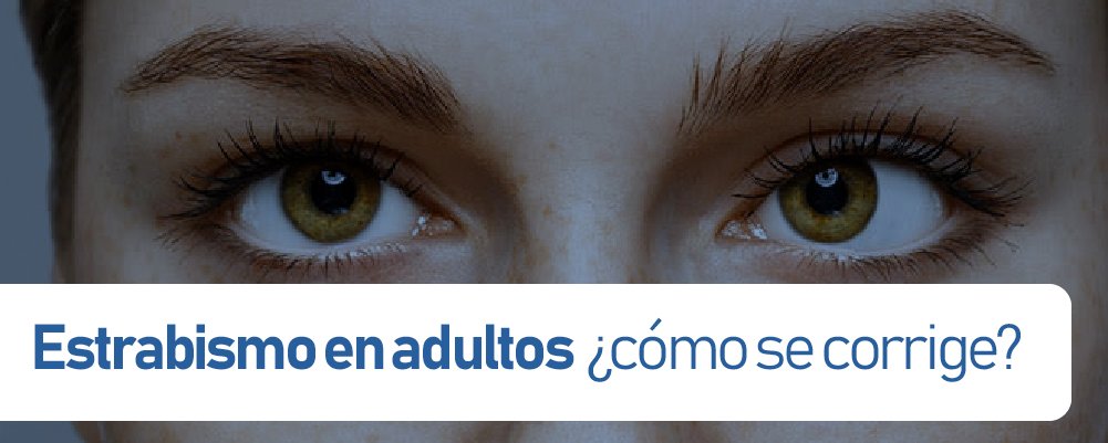 estrabismo en adultos