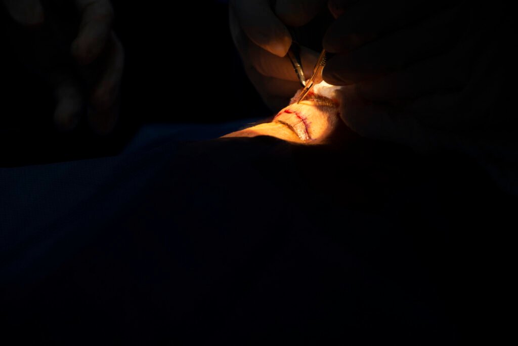 Blefaroplastia