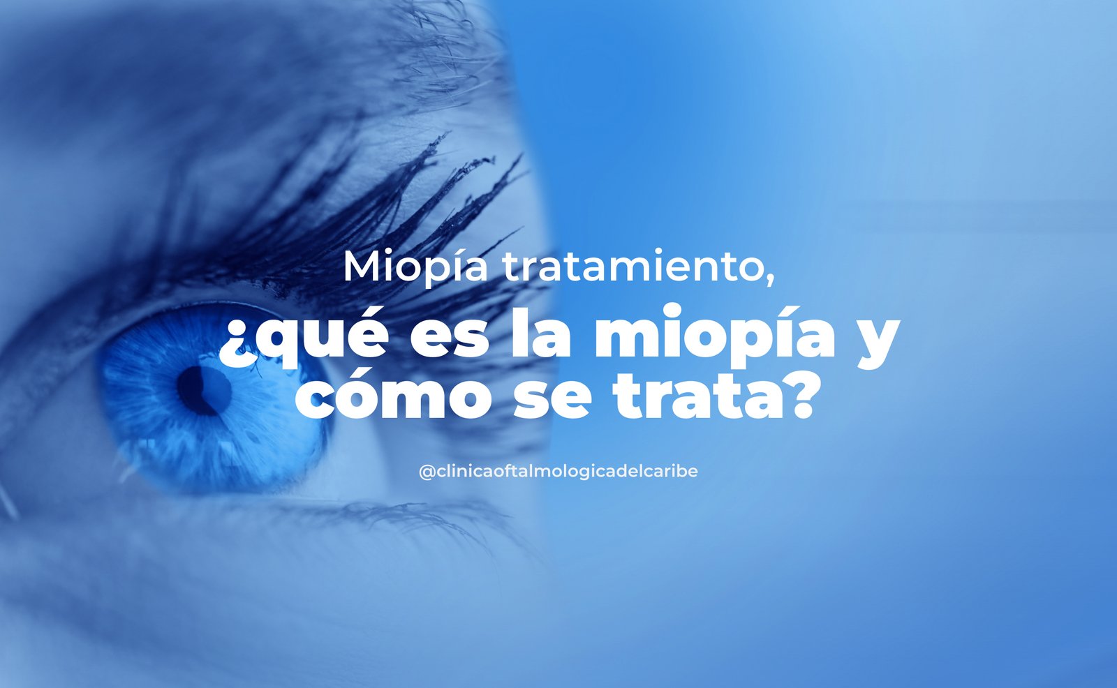 Defecto de refracción visual (miopía): visión borrosa de objetos lejanos debido al enfoque de la luz delante de la retina; diagnóstico y tratamientos disponibles