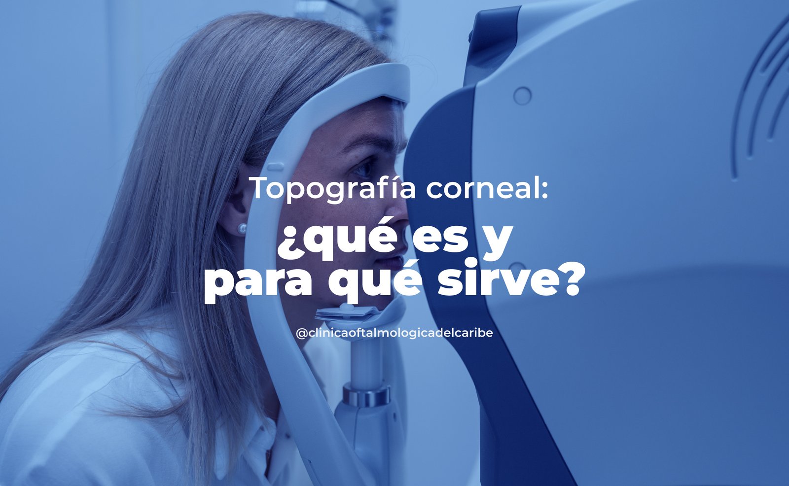 Topografía corneal en COFCA Barranquilla: examen no invasivo que crea mapa 3D de la córnea para detectar astigmatismo, queratocono, adaptar lentes de contacto y planear cirugía refractiva