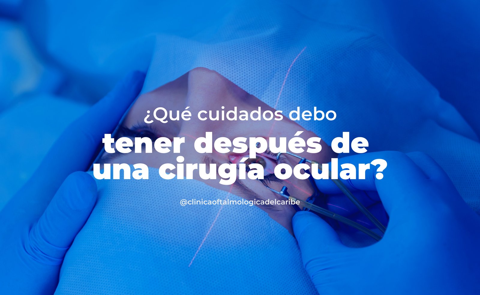 Cuidados esenciales tras cirugía ocular en COFCA Barranquilla: seguir instrucciones médicas, descanso visual, uso de gafas de sol, compresas frías, citas de seguimiento y dieta con antioxidantes