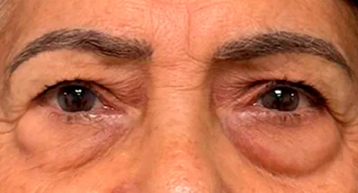Rostro