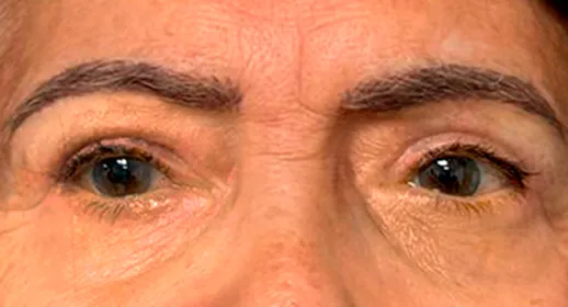 Rostro