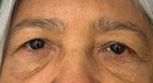 Rostro