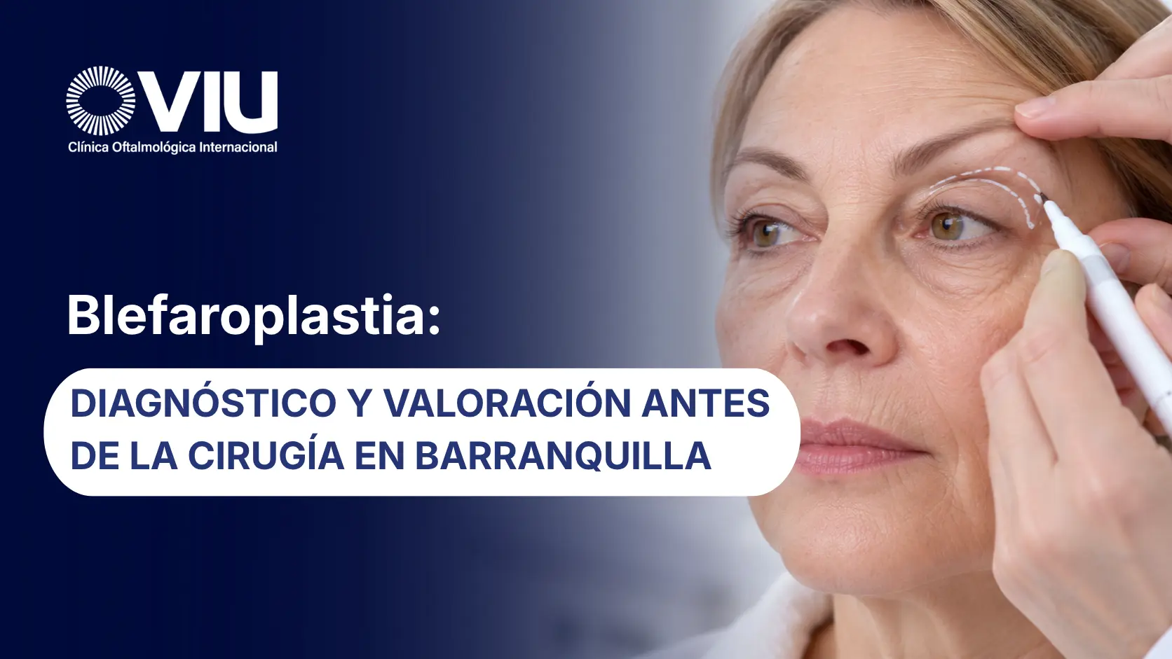Blefaroplastia diagnóstico y valoración antes de la cirugía en Barranquilla - VIU - Colombia