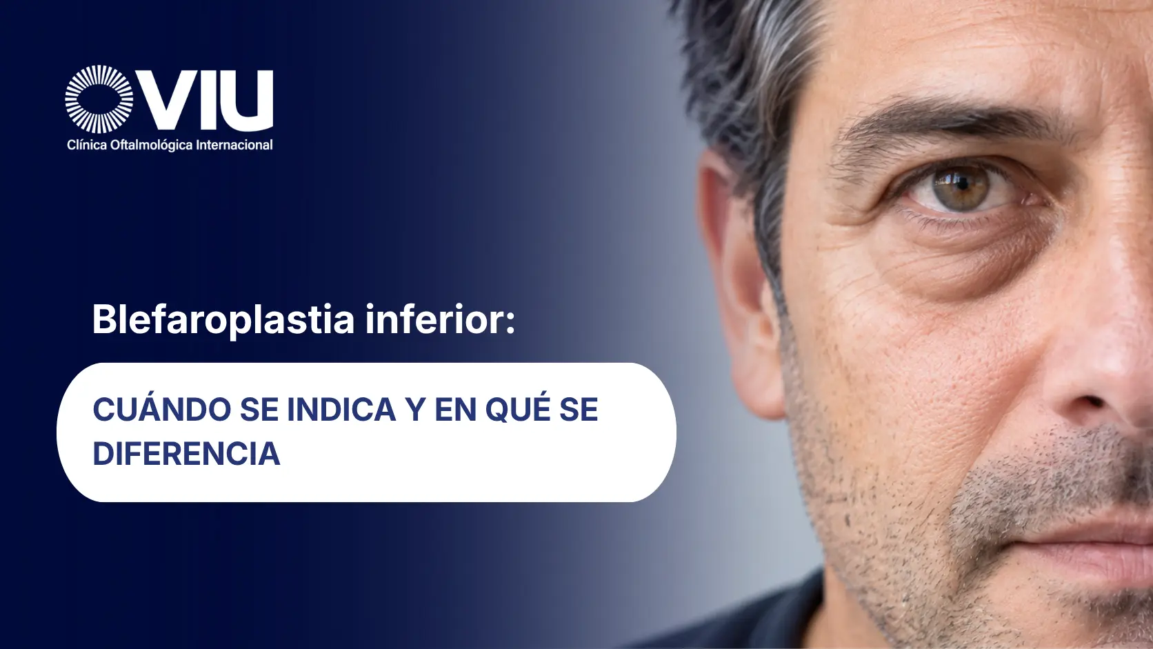 Blefaroplastia inferior - VIU Clínica Oftalmológica Internacional - Barranquilla, Colombia