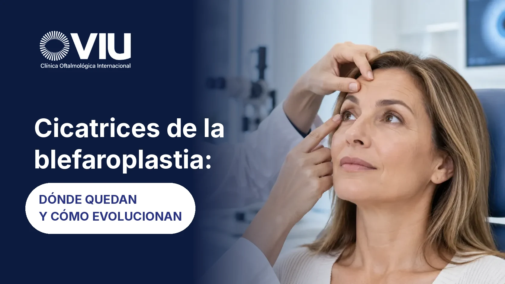 Cicatrices de la blefaroplastia: dónde quedan y cómo evolucionan