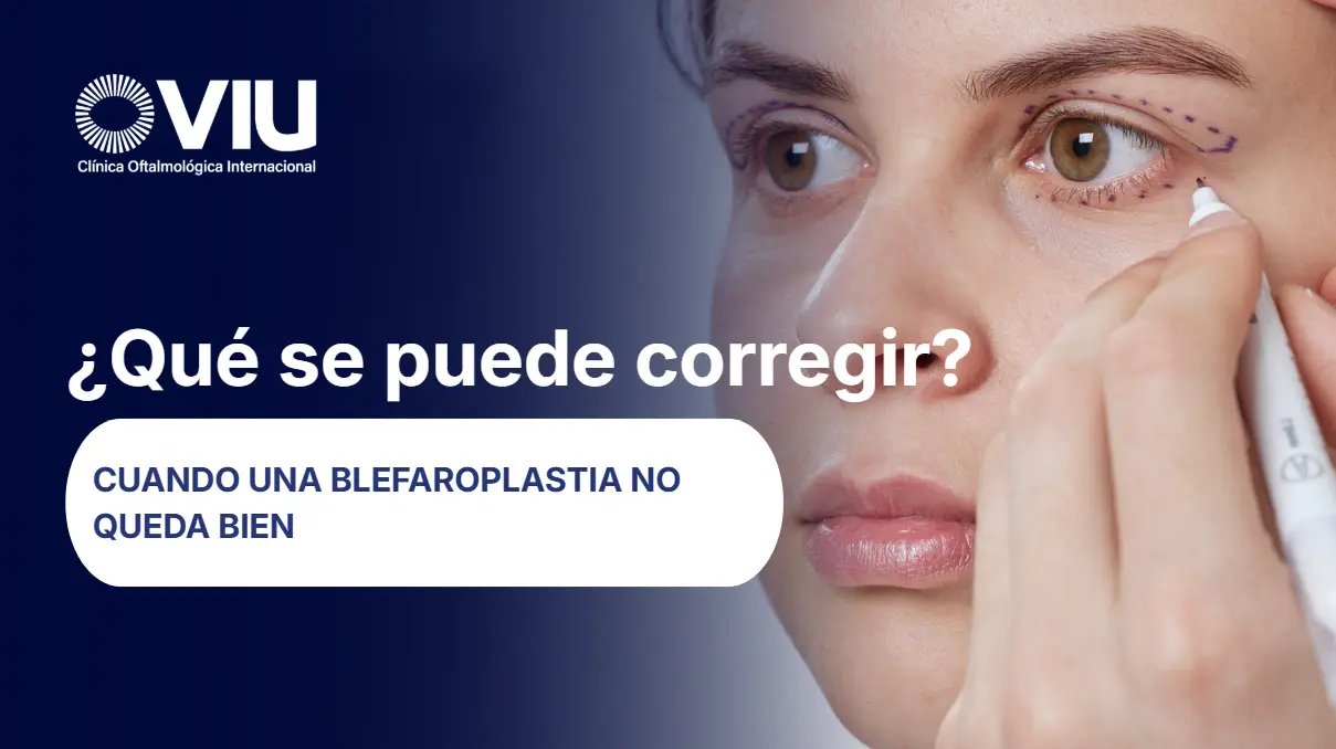 Cuando una Blefaroplastia no queda bien- VIU Clínica Oftalmológica Internacional