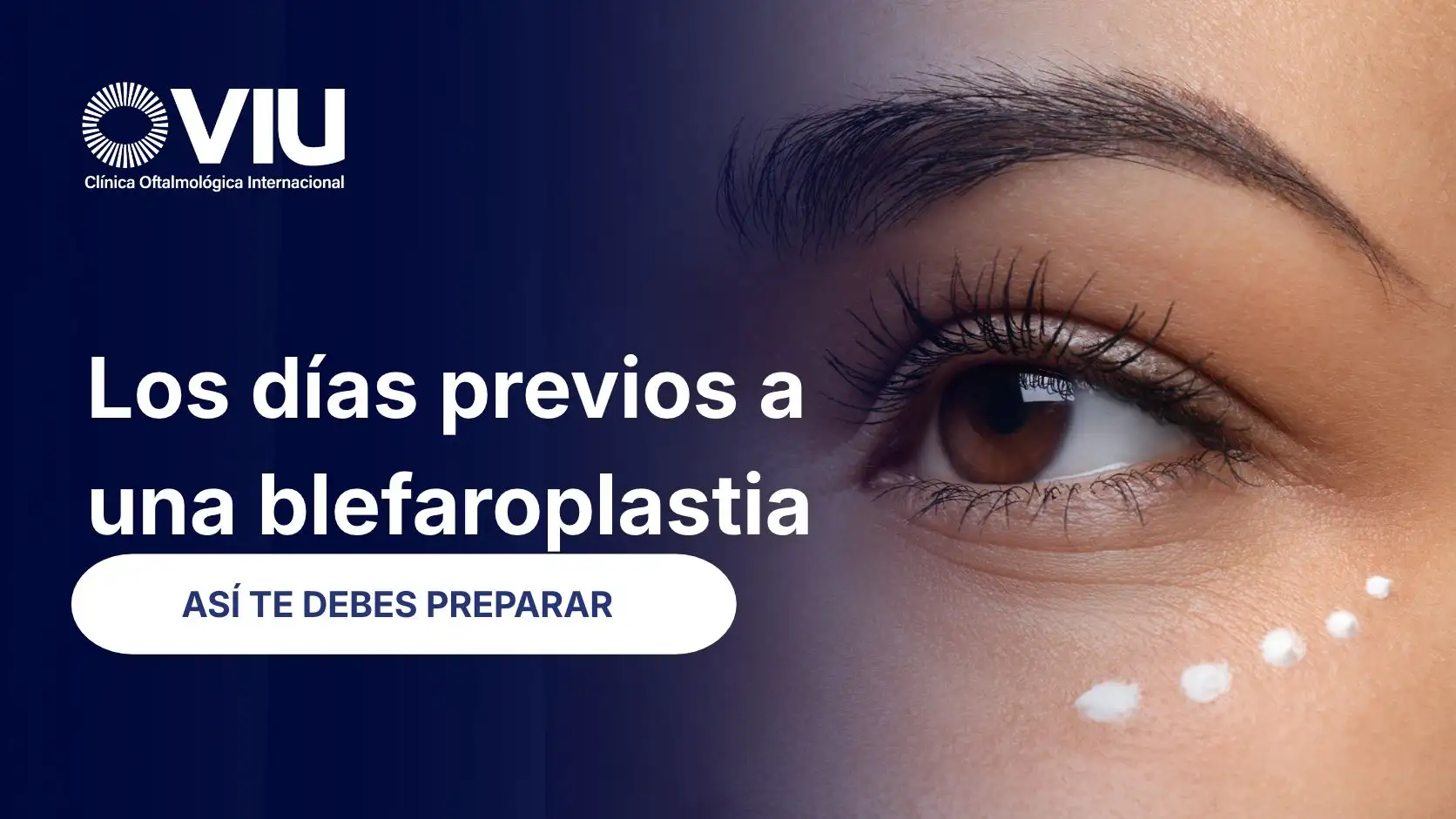 Cómo prepararse para una blefaroplastia: los días previos